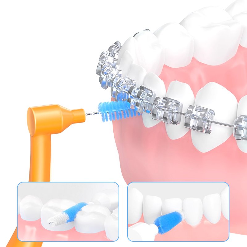 Interdental Brush 11 how do interdental brushes work