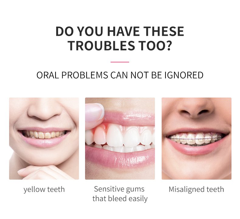 electric toothbrush rlt254 details 2