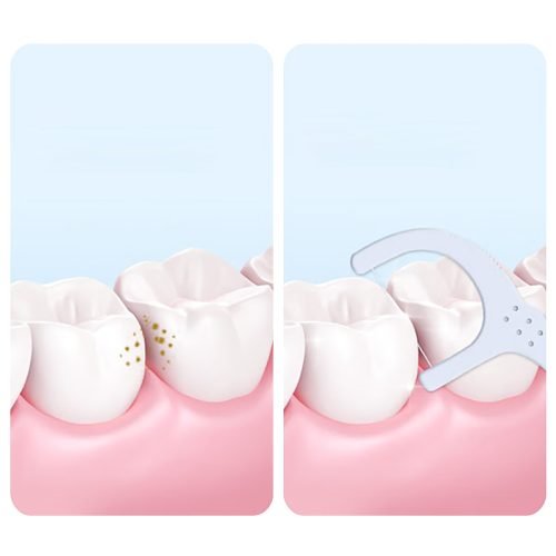 How-to-use-dental-floss